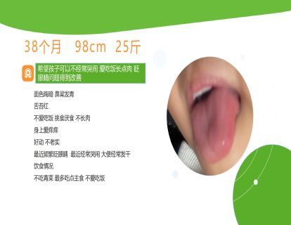 案例二：阴虚内热眨眼睛